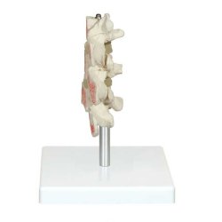 Osteoporose model