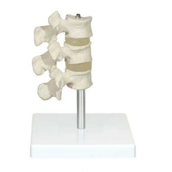 Osteoporose model
