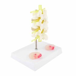 Lnderygs model med diskeprop