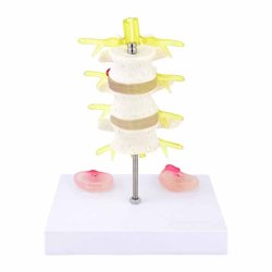 Lnderygs model med diskeprop