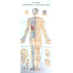 3 akupunktur plakater (Engelsk)