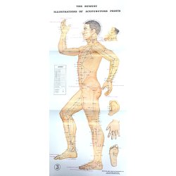 3 akupunktur plakater (Engelsk)